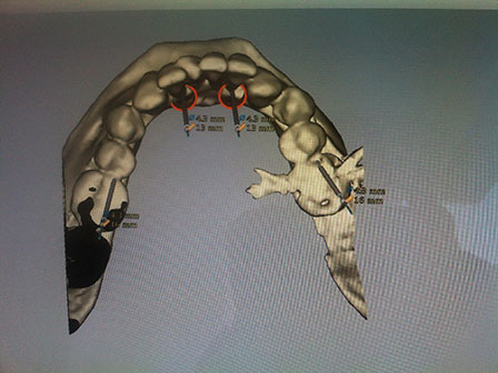 CAD CAM Cirujano Maxilofacial CDMX